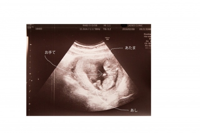 【発生生物学】妊娠初期の胎盤内細胞のアトラス