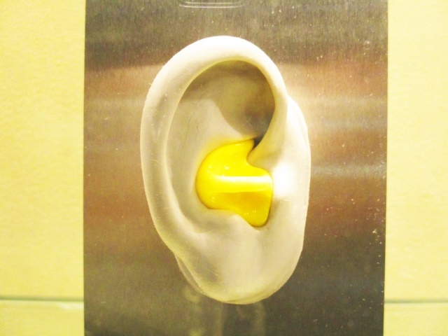 【遺伝子治療】ヒトの難聴のマウスモデルにおける聴力回復